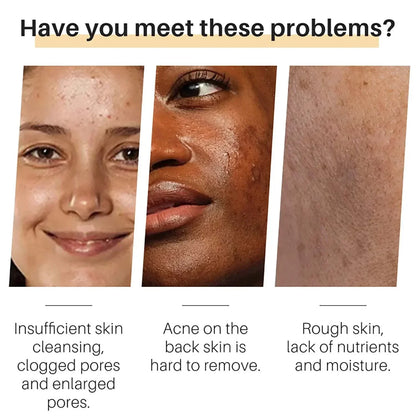 Turmeric Glow Soap – Fades Dark Spots & Evens Skin Tone